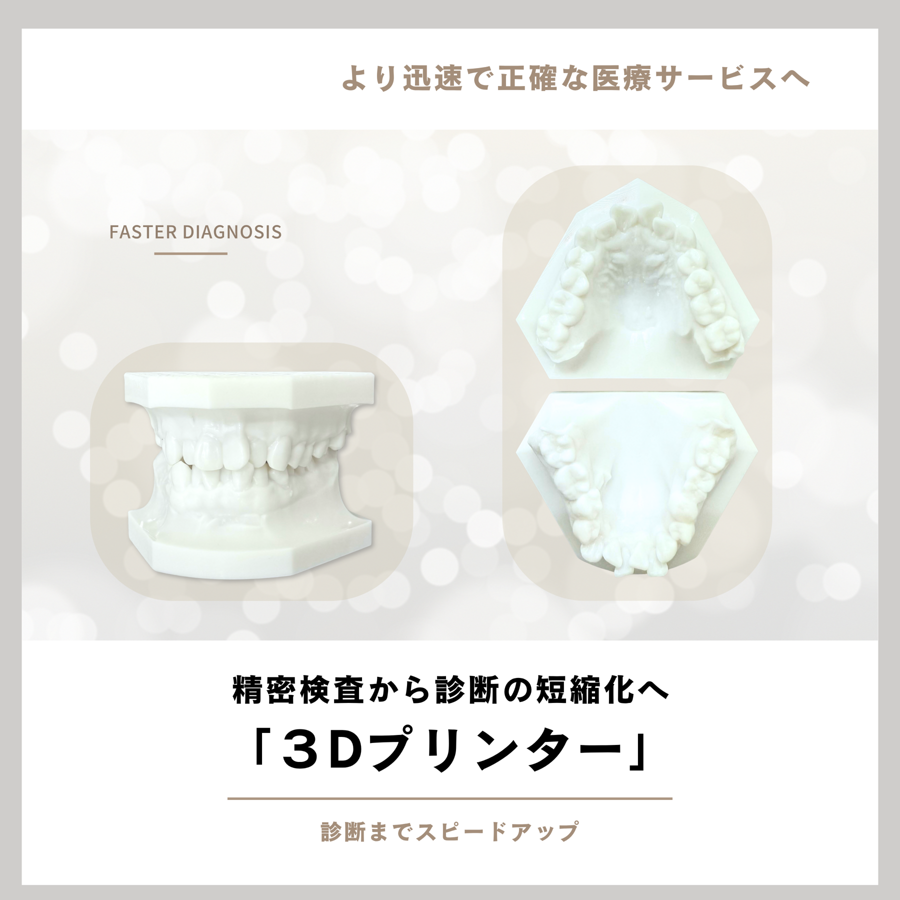 3Dプリンターで作製した診断用模型