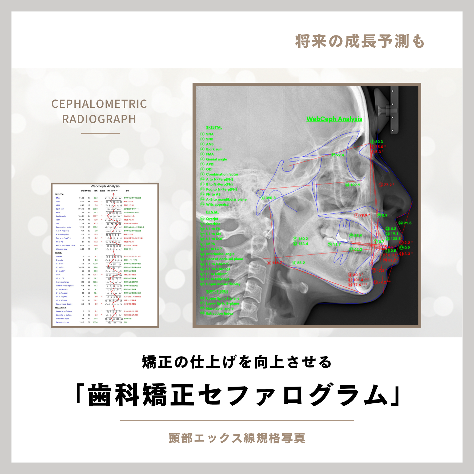 セファログラムによる成長予測と歯科矯正分析