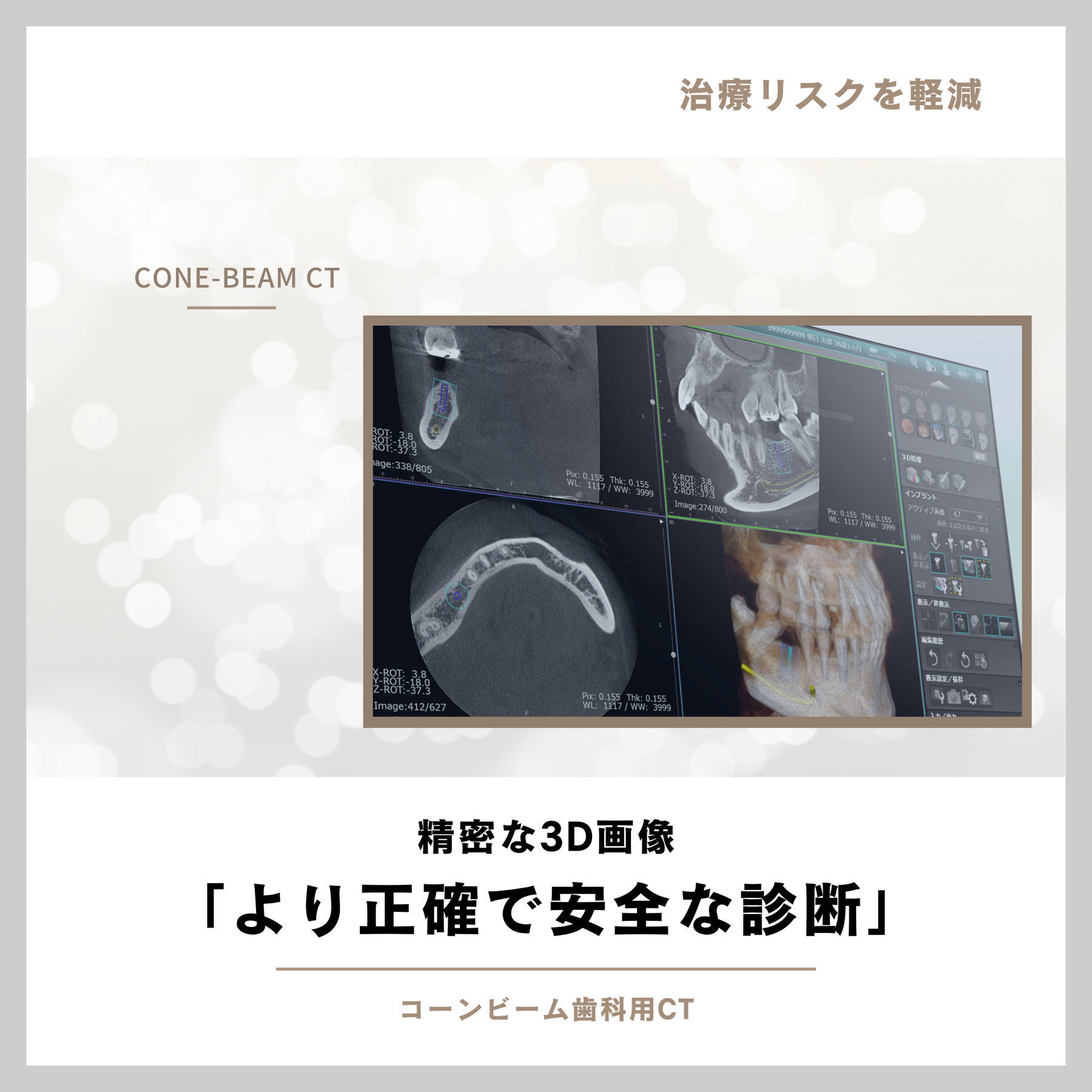 コーンビーム歯科用CTによる精密な3D画像診断