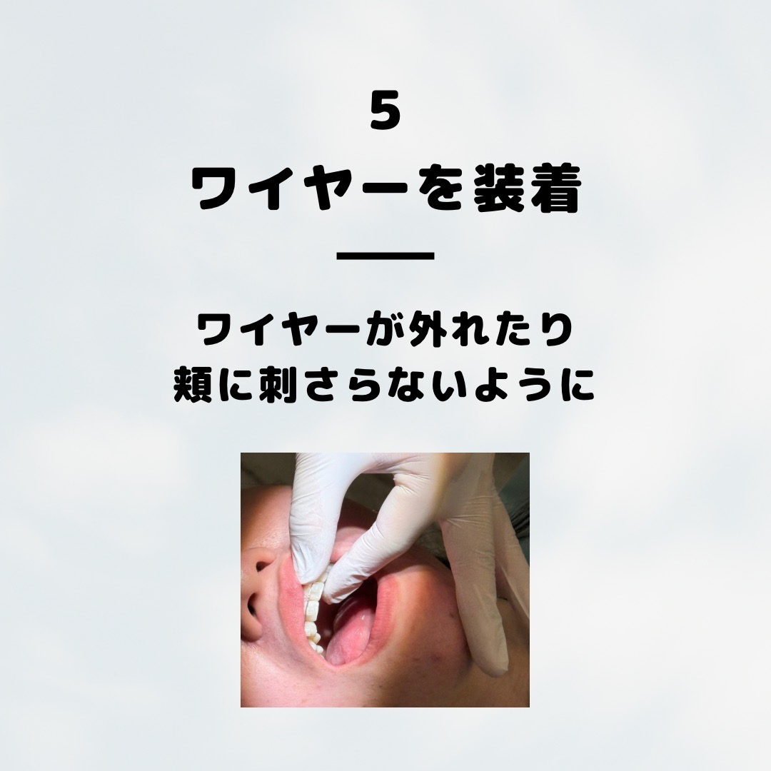 動的処置